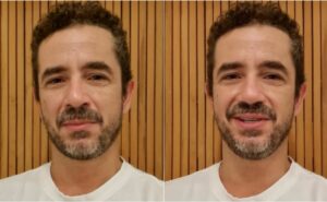 felipe andreoli sofre acidente de carro indo para a globo: "pancada foi forte"