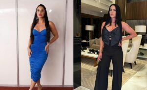 graciele lacerda expõe implante de cabelo de zezé di camargo e leva bronca