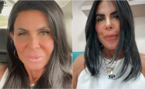 gretchen faz cirurgia para a retirada do útero: "nada maligno"