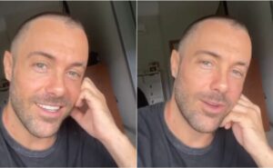 kayky brito está em elenco de filme após seis meses de seu atropelamento