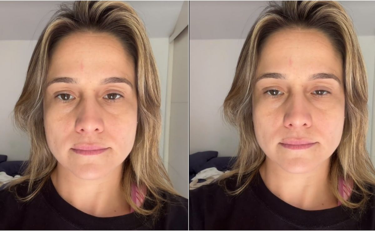 fernanda gentil desabafa sobre tratamento contra paralisia de bell e manda recado: "dói"