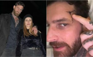 marido de cleo pires sofre traumatismo craniano após queda e atriz se pronuncia