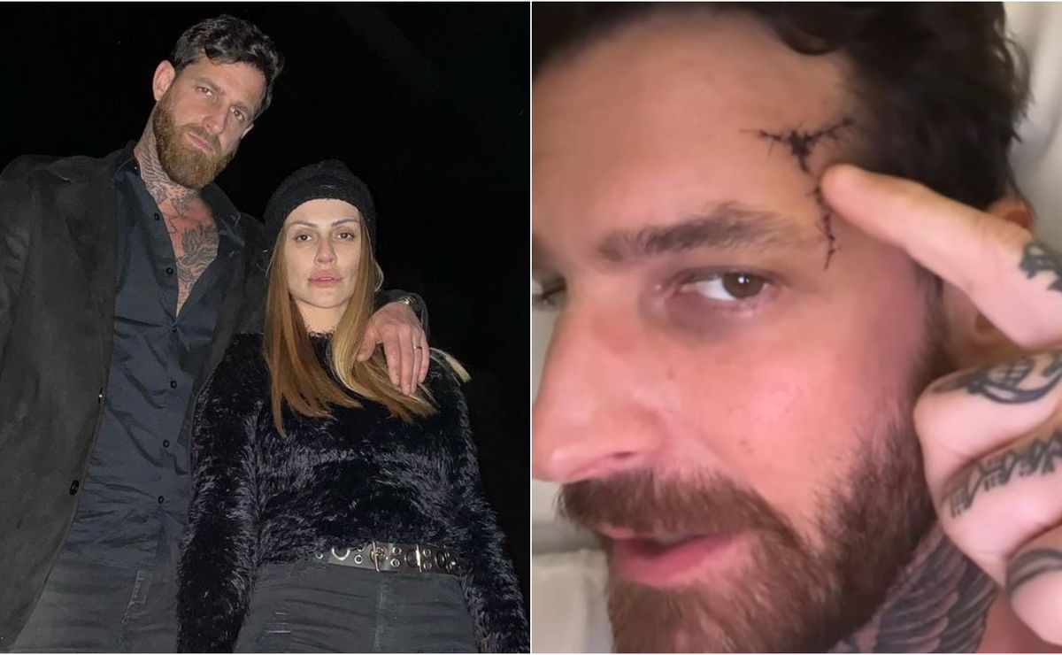 marido de cleo pires sofre traumatismo craniano após queda e atriz se pronuncia