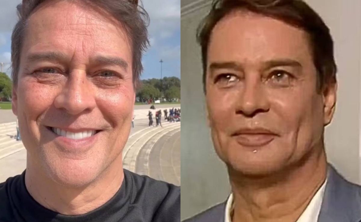 marcello antony passa por harmonização facial e é chamado de ken humano; esposa defende ator