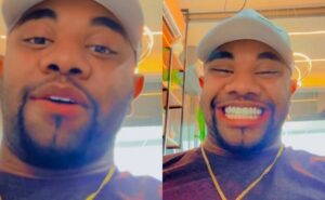 "deu um grau"; davi brito, do bbb 24, mostra resultado de procedimento estético