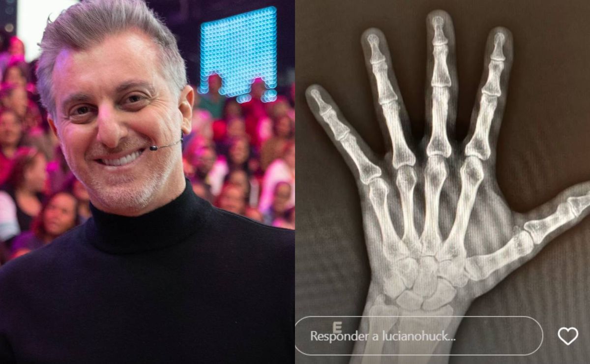 luciano huck tranquiliza fãs após sofrer acidente doméstico e parar no hospital