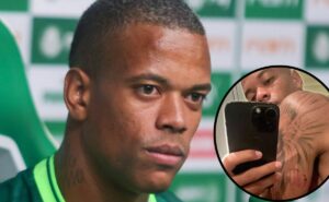caio paulista, do palmeiras, nega agressões e relata ter levado socos da ex mulher à polícia